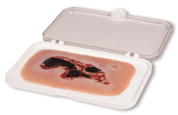 Wundmoulage Ulcus Cruris Arteriosum Exsudationsphase klein