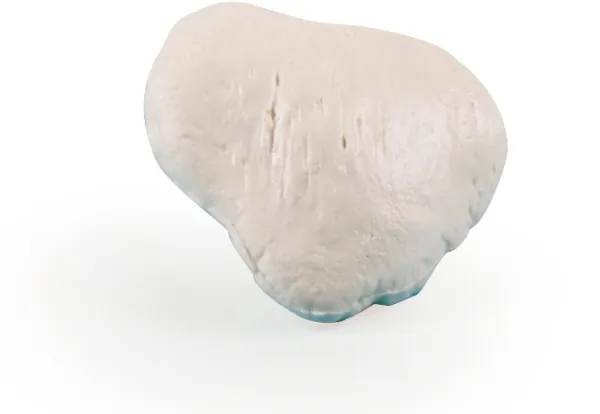 Patella (Kniescheibe) Modell