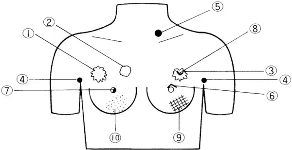 Brustkrebs-Untersuchungs-Tastmodell