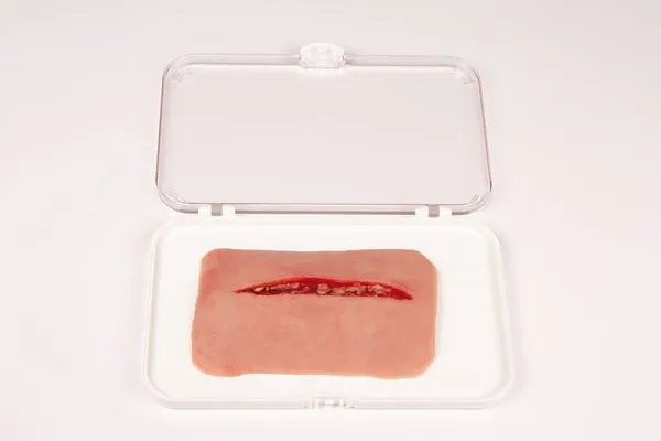 Wundmoulage Schnittwunde