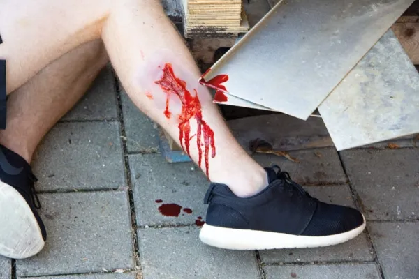 Wundmoulage Risswunde