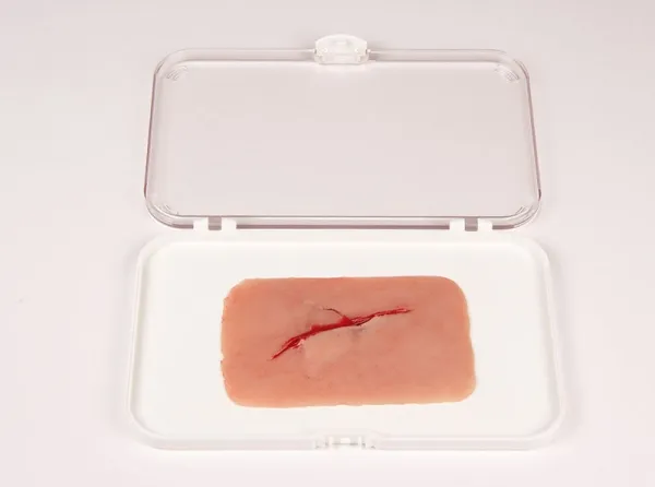 Wundmoulage Schnittwunde mit Glassplitter