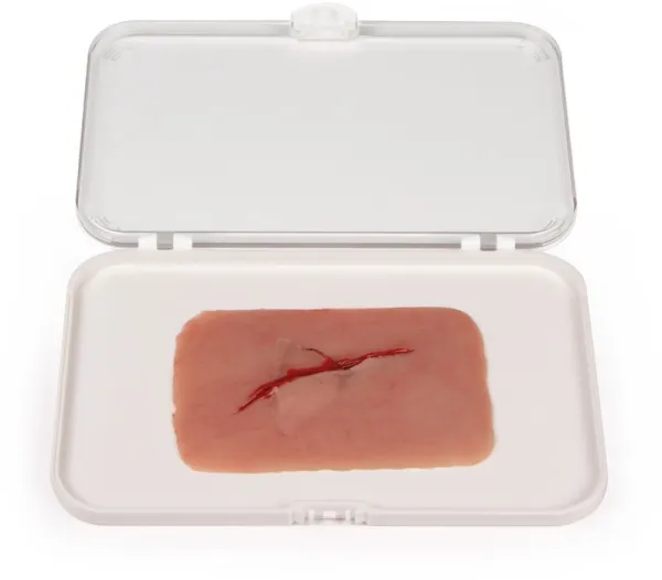Wundmoulage Schnittwunde mit Glassplitter