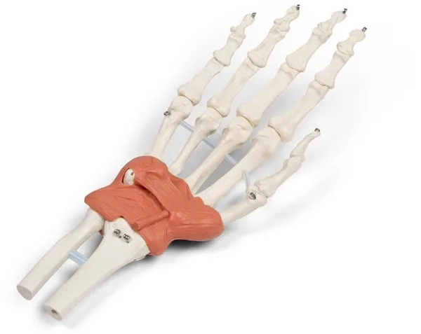 Bandapparat des Handgelenks