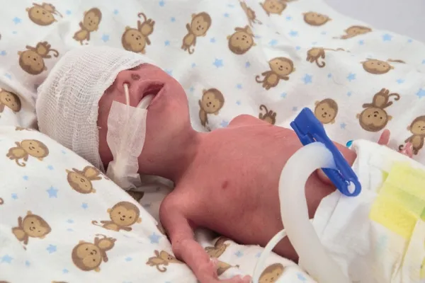 NENA Sim Preemie Xcel Frühgeborenenpuppe