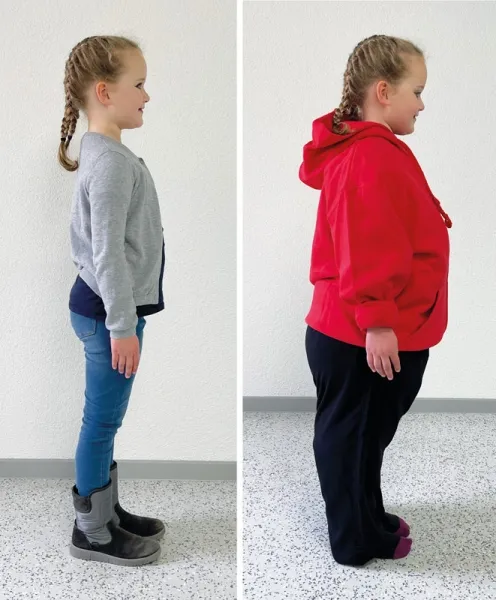 PAT Junior – Kinder Adipositas Trainer