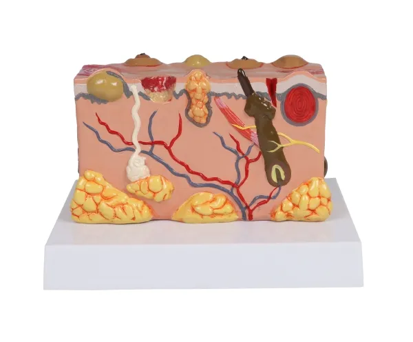 Pathologisches Hautmodel
