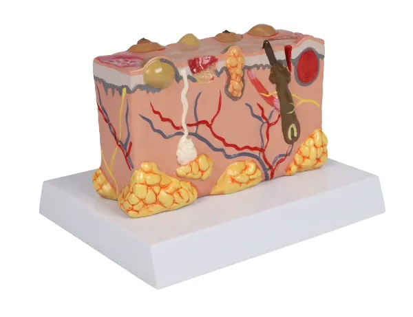 Pathologisches Hautmodel