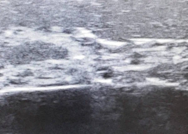 Ultraschall Gesicht