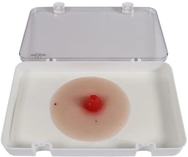 Wundmoulage Ileostoma, selbsthaftend