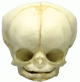 Fetusschädel, 35 Wochen