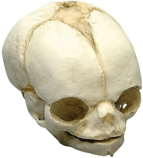 Fetusschädel, 21 ½ Wochen