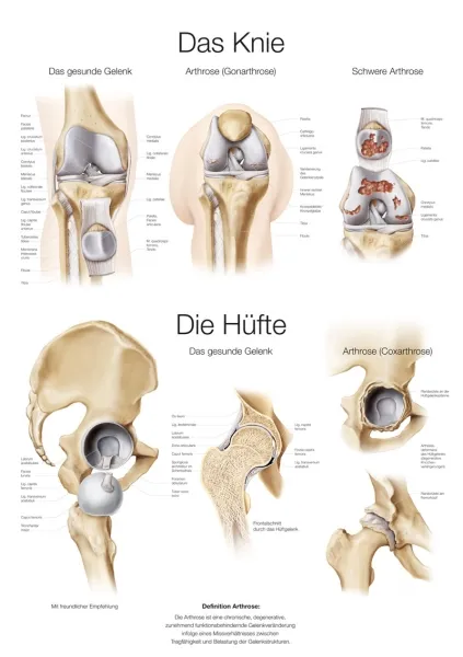 Lehrtafel &quote;Das Knie / Die Hüfte&quote;, 50x70cm