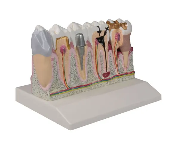 Dentalmodell, 4-fache Grösse