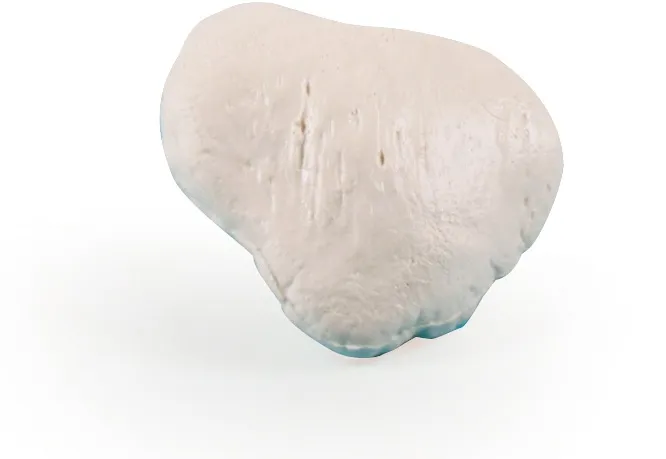 Patella (Kniescheibe) Modell