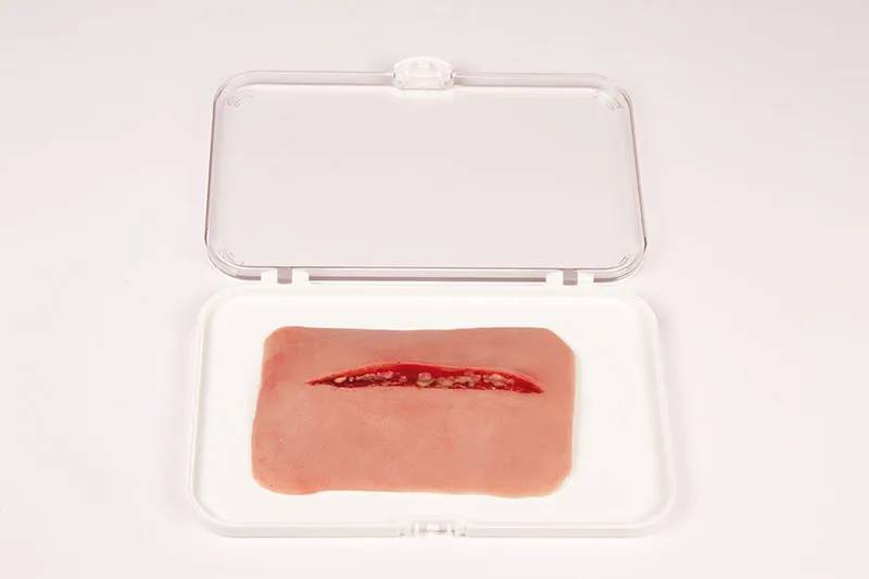 Wundmoulage Schnittwunde