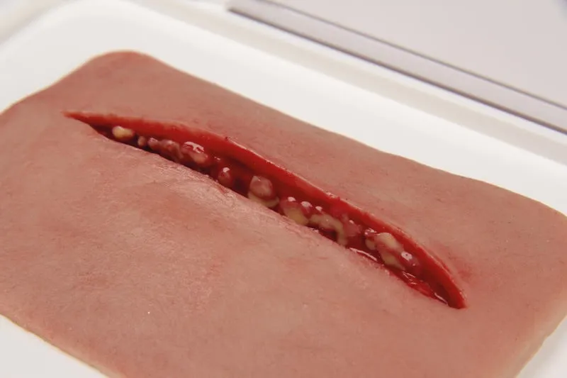 Wundmoulage Schnittwunde