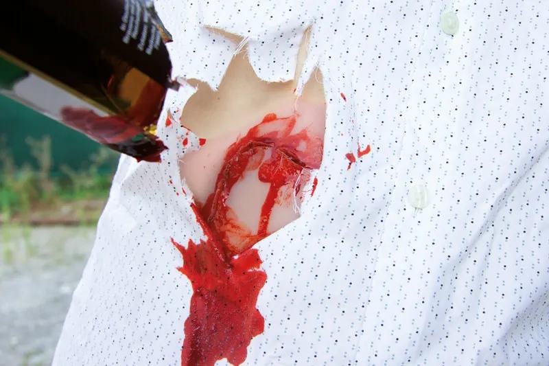 Wundmoulage Schnittwunde Flasche