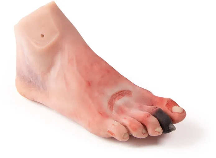 Wundenfuss mit diabetischem Fusssyndrom, für Puppe