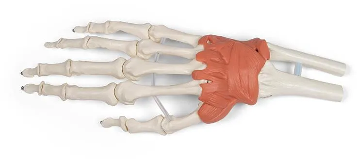 Bandapparat des Handgelenks