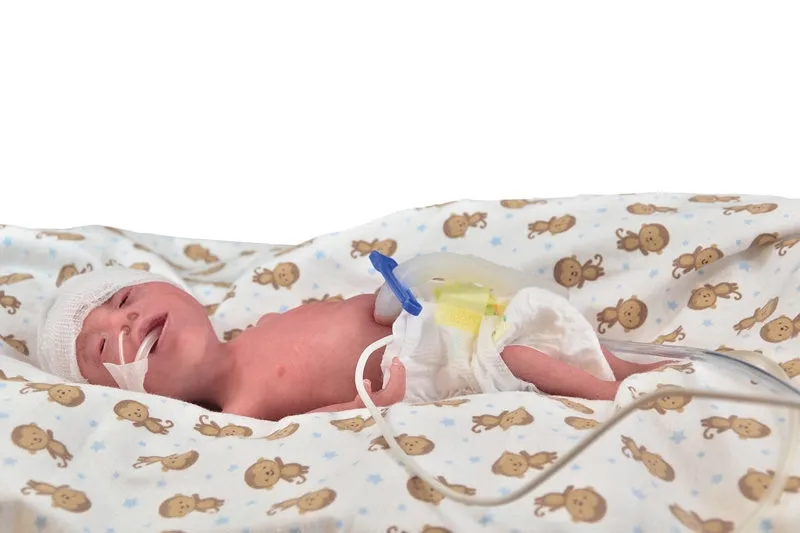 NENA Sim Preemie Xcel Frühgeborenenpuppe