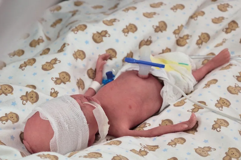 NENA Sim Preemie Xcel Frühgeborenenpuppe
