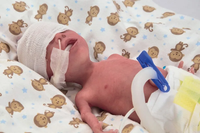 NENA Sim Preemie Xcel Frühgeborenenpuppe