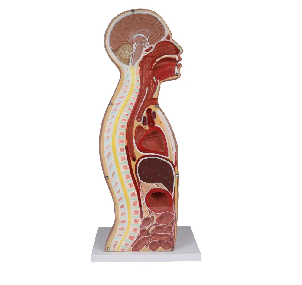 NG & Tracheostomie Torso, lebensgross