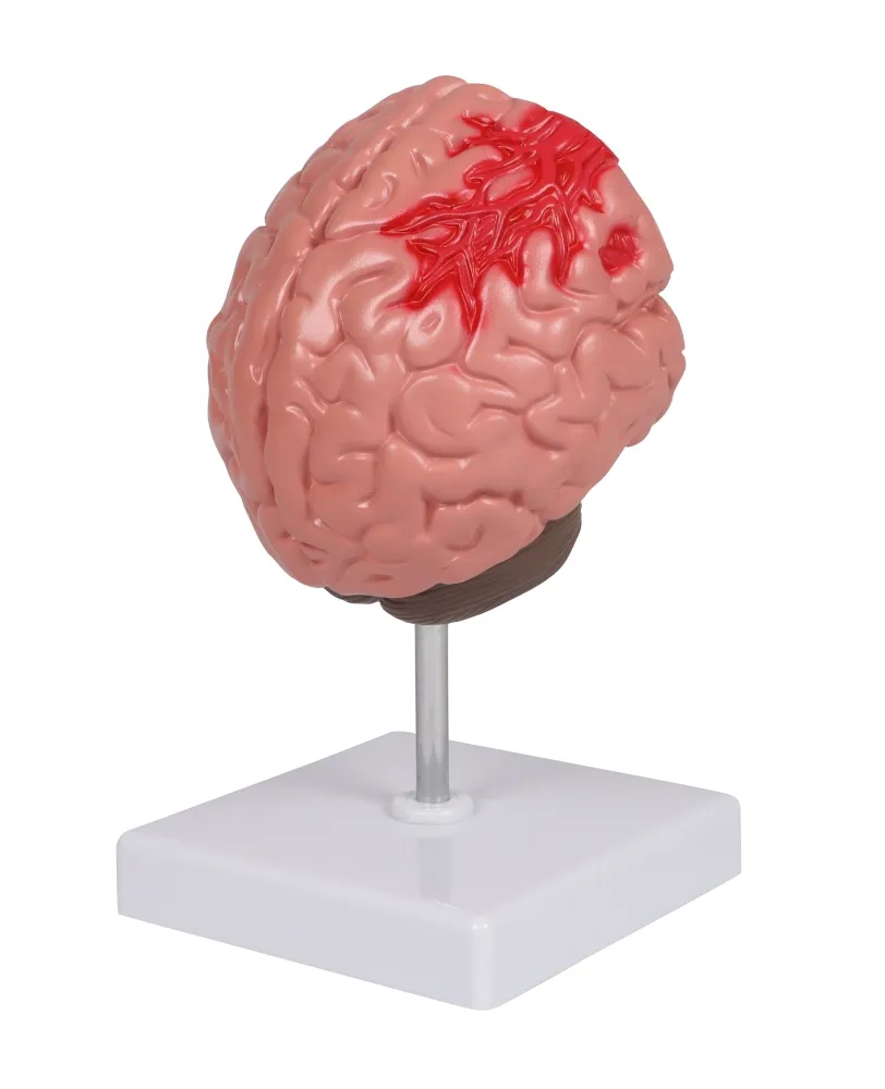 Pathologien des Gehirns, lebensgrösse