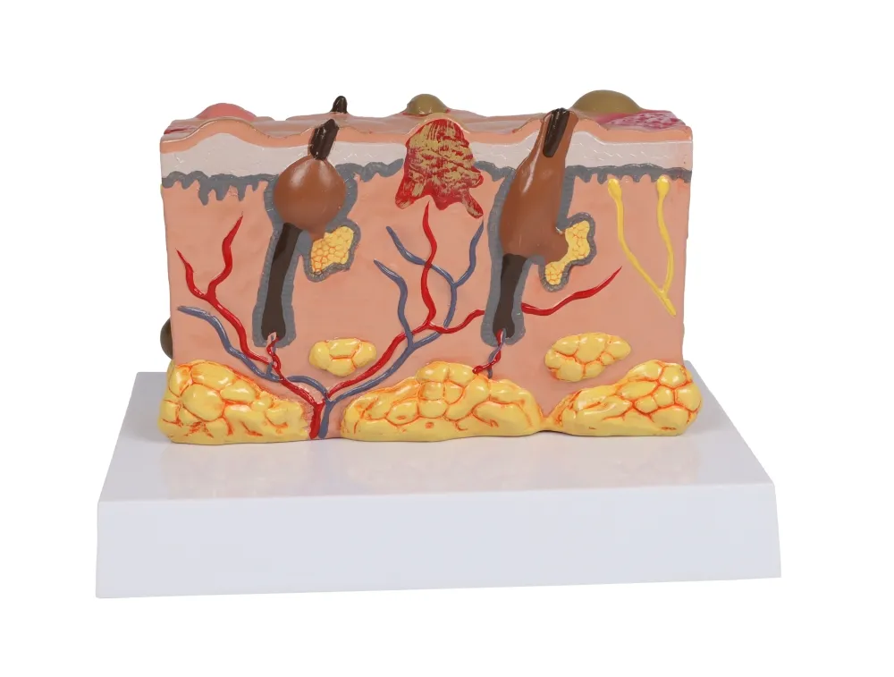 Pathologisches Hautmodel