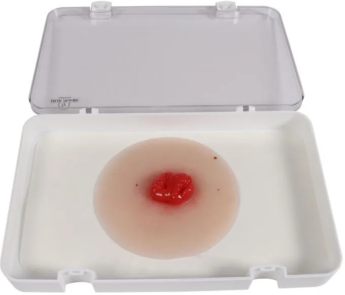 Wundmoulage Kolostoma doppelläufig, selbsthaftend