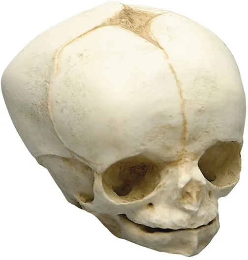 Fetusschädel, 34 Wochen