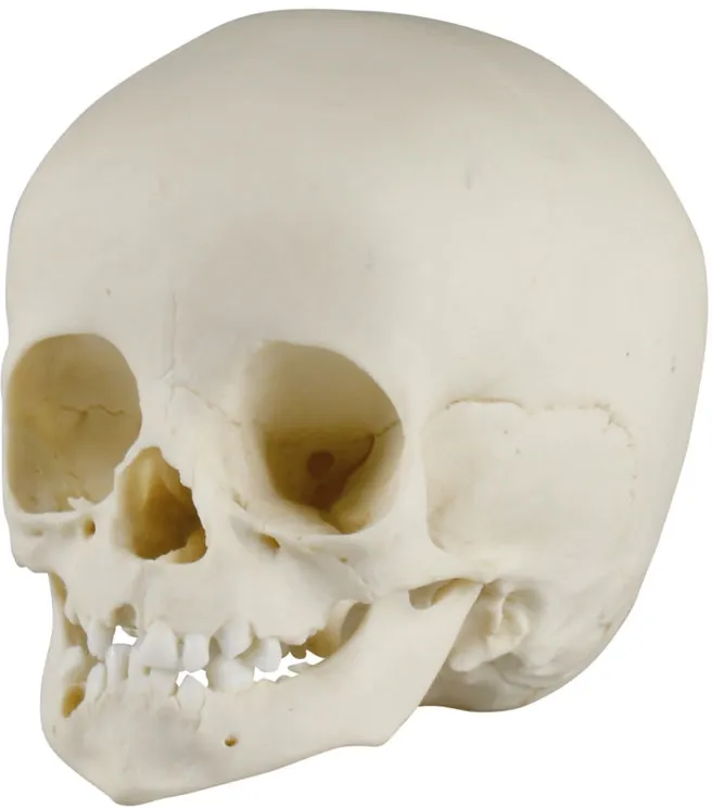 Kinderschädel, 14 Monate