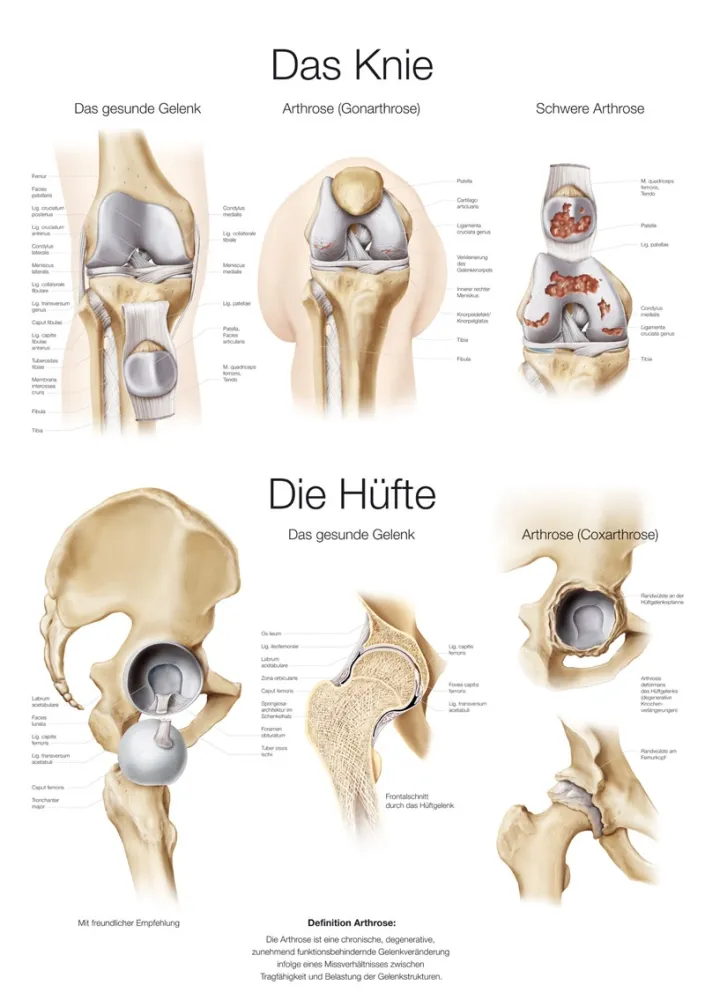 Lehrtafel &quote;Das Knie / Die Hüfte&quote;, 50x70cm