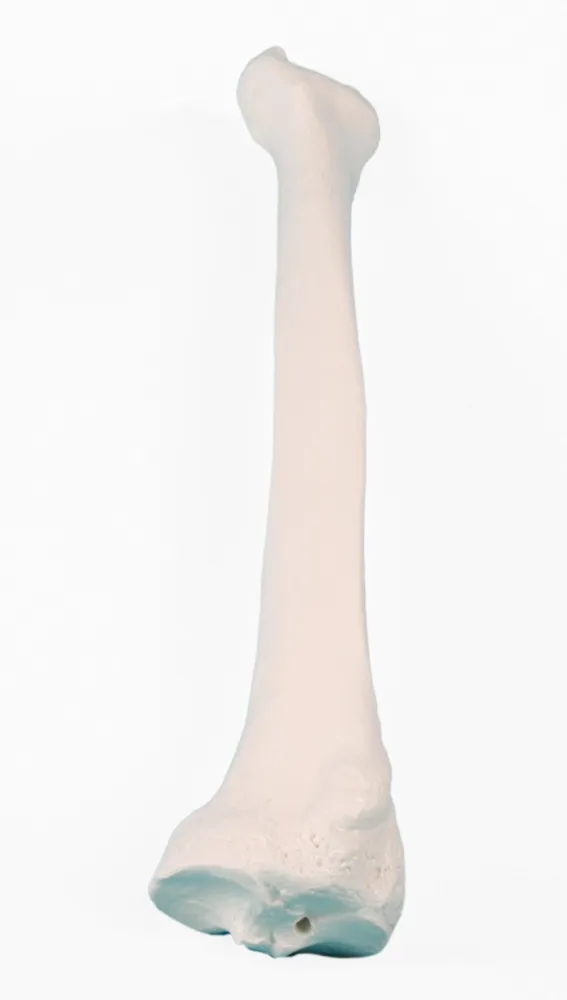 Radius (Speiche) Modell