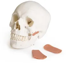 Schädelmodell für Zahnmedizin mit CMD Syndrom, 8-teilig
