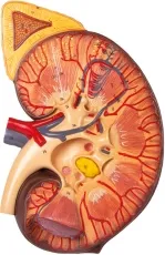 Nierenschnitt, Nephron und Nierenkörperchen