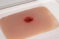 Wundmoulage Einschusswunde