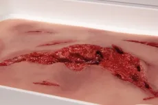 Risswunde gross mit Blutungsfunktion