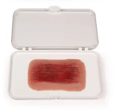 Wundmoulage Schürfwunde