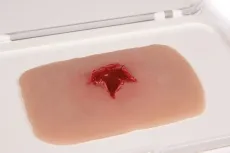 Wundmoulage Schuss Austrittswunde