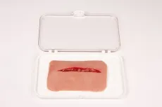 Wundmoulage Schnittwunde