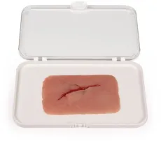 Wundmoulage Schnittwunde mit Glassplitter