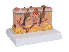 Pathologisches Hautmodel