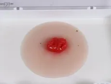 Wundmoulage Kolostoma doppelläufig, selbsthaftend
