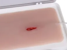 Wundmoulage Stichwunde mit Blutungsfunktion