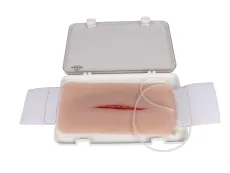Wundmoulage Halsschnitt