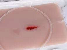 Wundmoulage Stichverletzung Hals