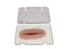 Wundmoulage Suizidversuch