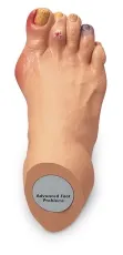 Erweiterte Fussprobleme